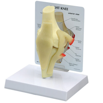 Basic Knee Model with Base