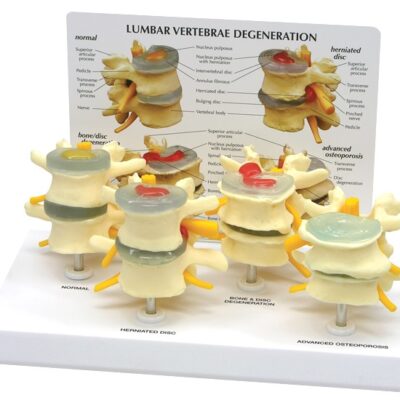 Four Stage Vertebrae Model with Base